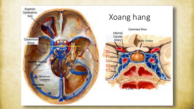 Huyết khối xoang hang - Hình ảnh minh họa